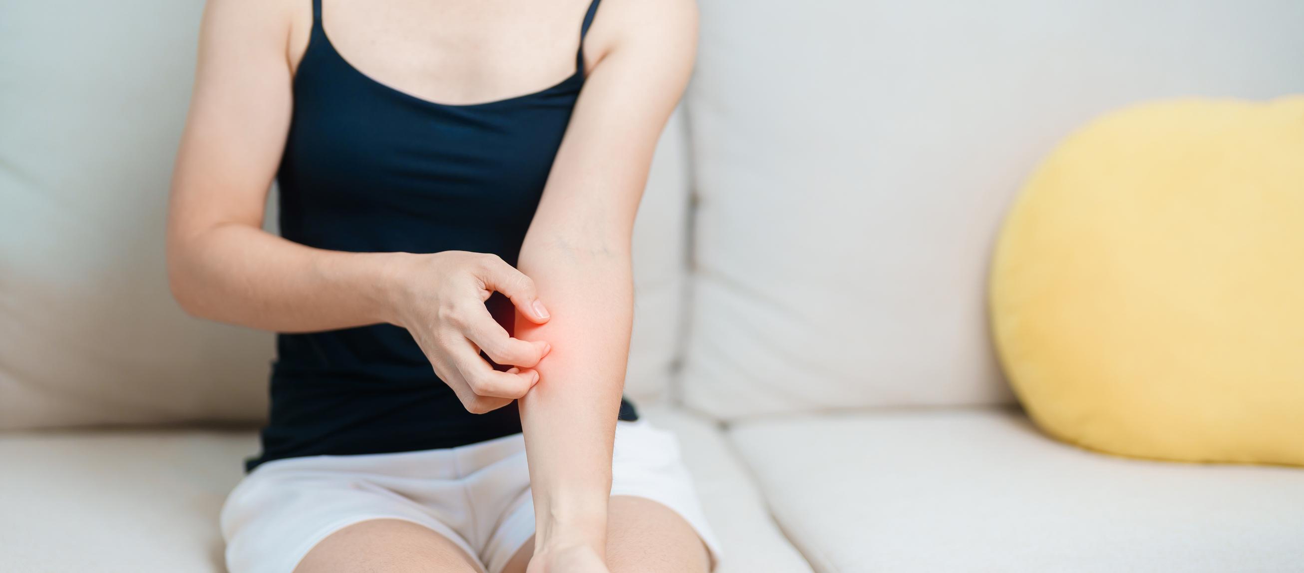 Sommerstress für die Haut: Neurodermitis gezielt lindern